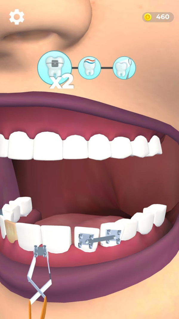 假牙医生游戏1