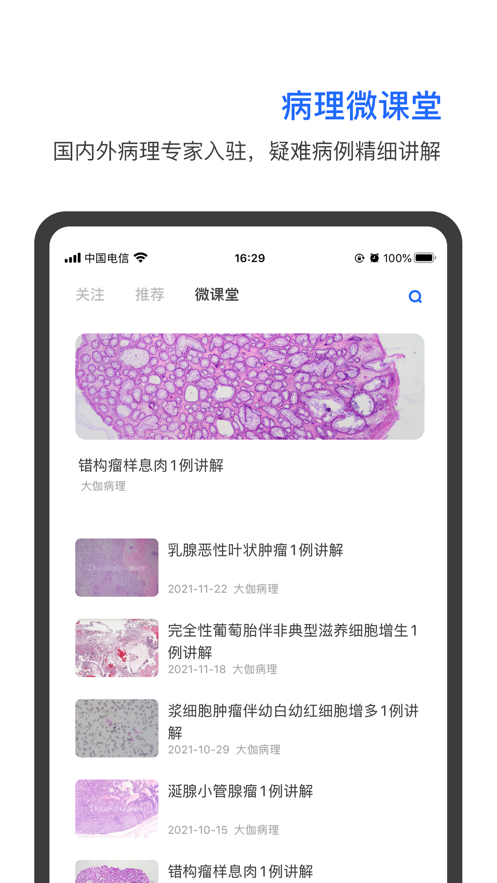 大伽病理0