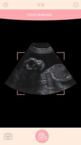 胎儿相机1
