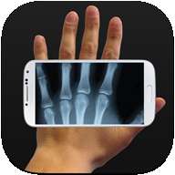 Xray Prank