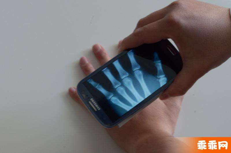 Xray Prank2
