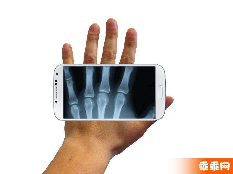 Xray Prank3