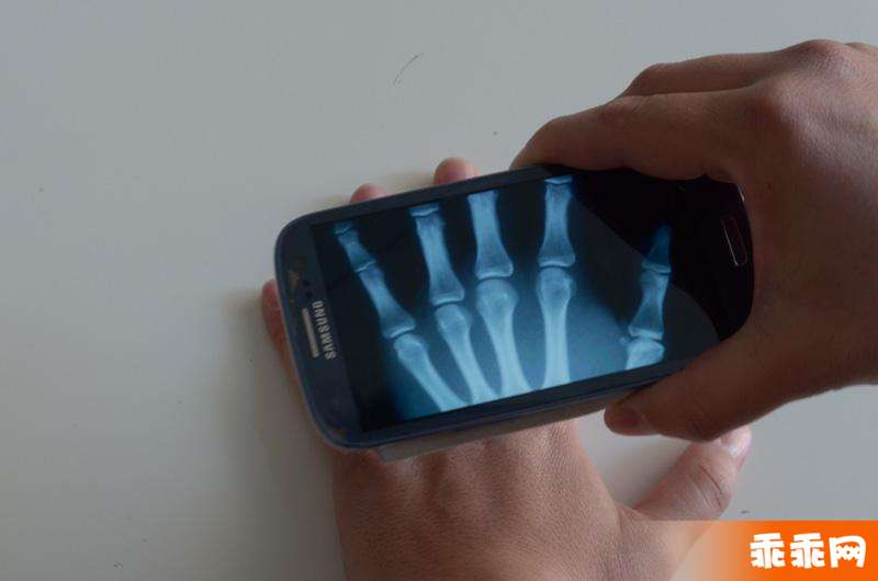 Xray Prank7