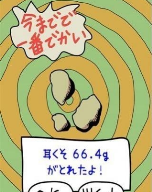 挖耳屎1
