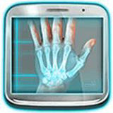X光扫描仪手机