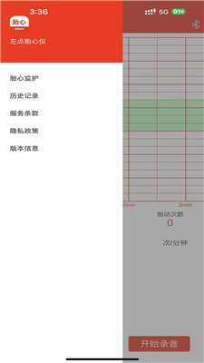 左点胎心仪2